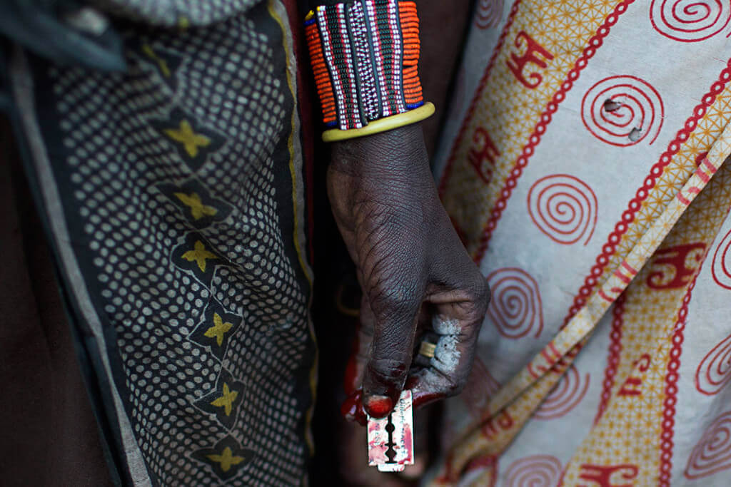 Should India Introduce a Law on Female Genital Mutilation?
